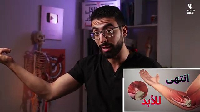 تخلص من الم والتهاب مرفق التنس نهائيا _ علاج طبيعى ل التنس البو _ Tennis elbow Treatment