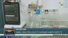 Israeli genocide leads to increase in birth defects
