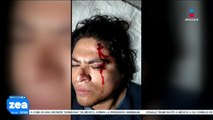 Reporteros de Imagen Televisión Puebla fueron agredidos mientras realizaban cobertura