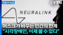 완전 실명도 시력 회복? 머스크가 바꾸는 인간의 미래 [지금이뉴스] / YTN