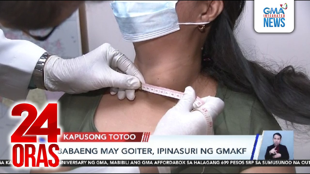 Babaeng may goiter, ipinasuri ng GMAKF | 24 Oras