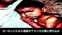 【豆知識】史上最悪パンデミック ワースト10　【Trivia News】The Worst Pandemics in History: Top 10
