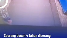 Bocah 4 Tahun Diserang Anjing Peliharaan Lepas di Warung Muncang Bandung, Korban Dilarikan ke RS