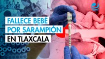 Bebé muere por complicaciones de sarampión en Tlaxcala; suman más de 20 defunciones en México