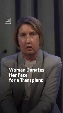 Woman Donates Her Face for a Transplant