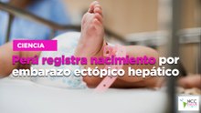 Perú registra nacimiento por embarazo ectópico hepático