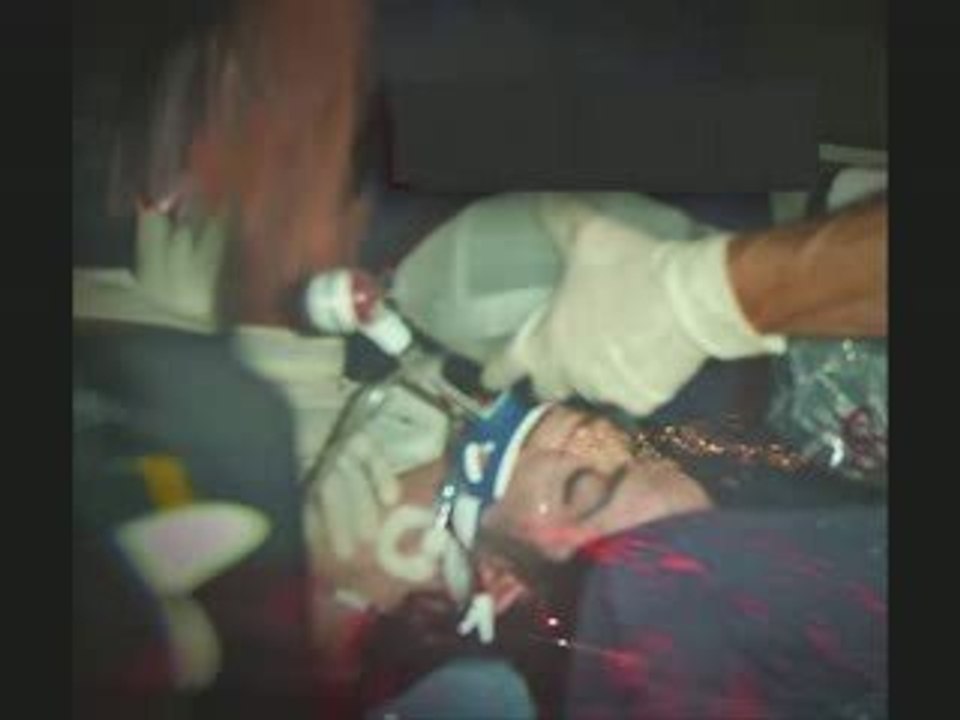 EXCLUSIF  Michael Jackson autopsie.