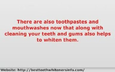 Best Teeth Whiteners - What Are The Options Available?