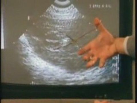 2/2 AVORTEMENT: LE BUSINESS DE LA FRANC MAÇONNERIE SATANIQUE