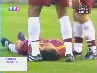 Sylvain Kastendeuch Fin de carrière - Ballon en plein visage