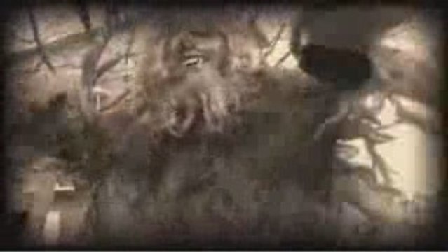 Laser hair removal - The Hazards of Being Hairy No. 9