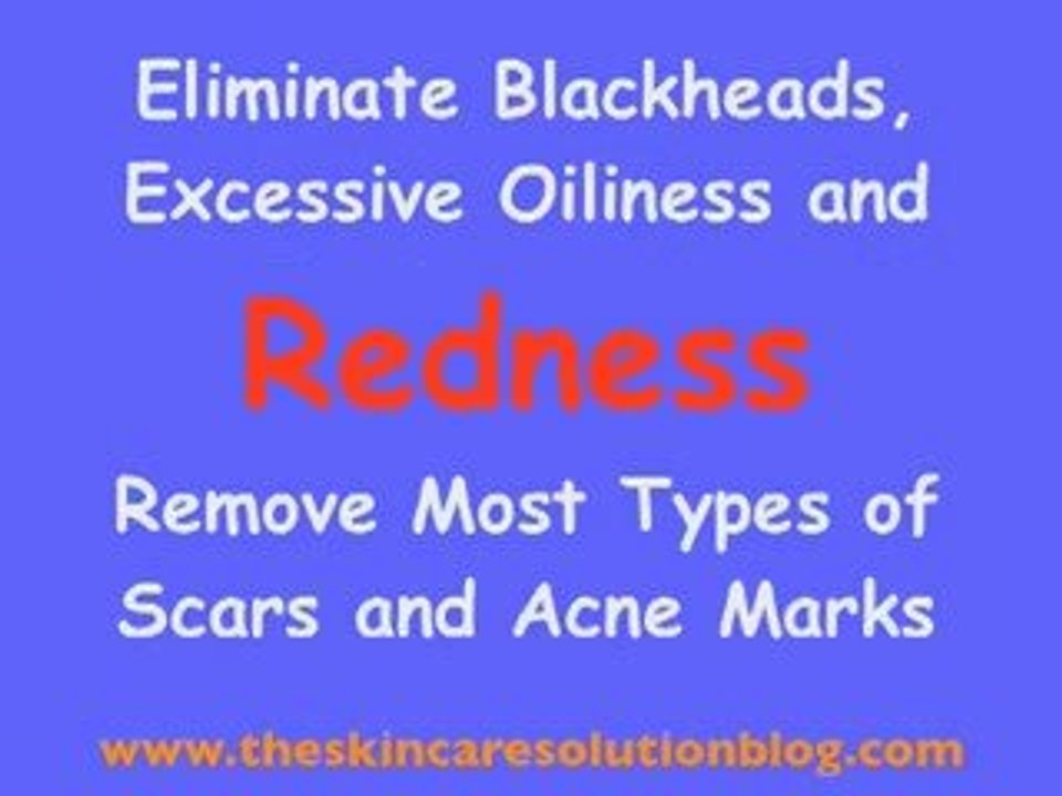 Acne No More