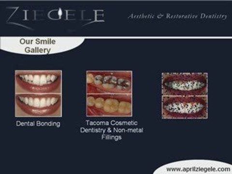 Seattle Cosmetic Dentist Dr. April Ziegele, DDS