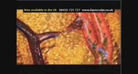 Weight Loss After Having A Baby