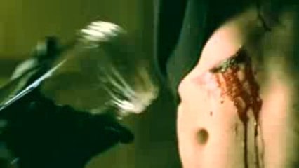 Clip 