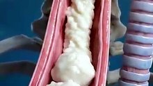 Eat Rice on an Empty Stomach Watch What Happens Next dailyhealthtips doctor healtheducation