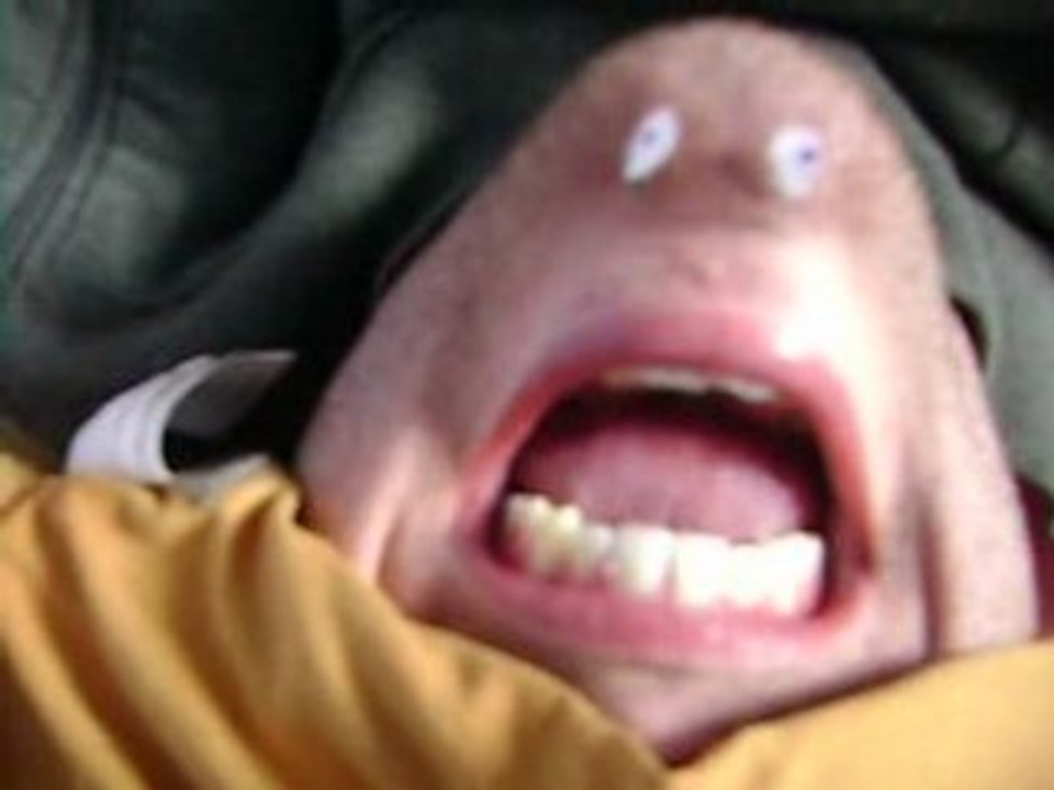 Chin face 2