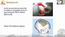 In-House Manufactured Peek Cranioplasty Implants – Initial Experience From Skåne University Hospital