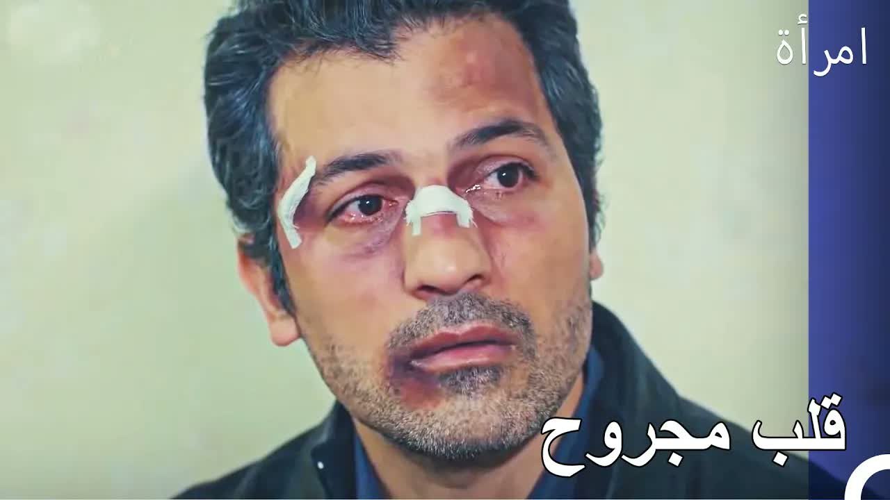 القلب المكسور يؤلم اكثر من العظام المكسورة - امرأة