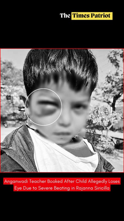 Anganwadi Teacher Booked After Child Allegedly Loses Eye Due to Severe Beating in Rajanna Siricilla