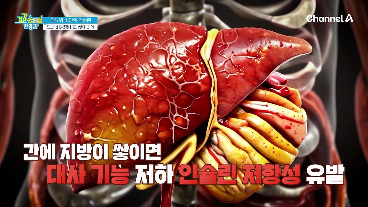 당뇨와 함께 찾아오는 고지혈증, 고혈압... 여주 분말로 악순환을 끊어라?!