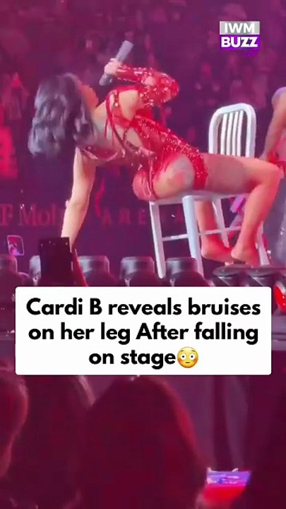 Hollywood singer Cardi B reveals bruises on her leg following a fall during her music concert