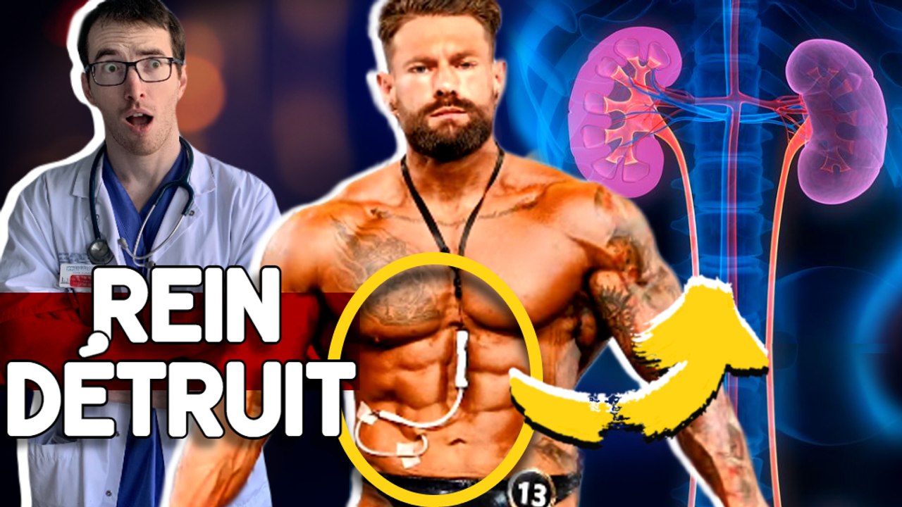 BODYBUILDER ET INSUFFISANT RÉNAL DIALYSÉ : COURAGE OU FOLIE ?