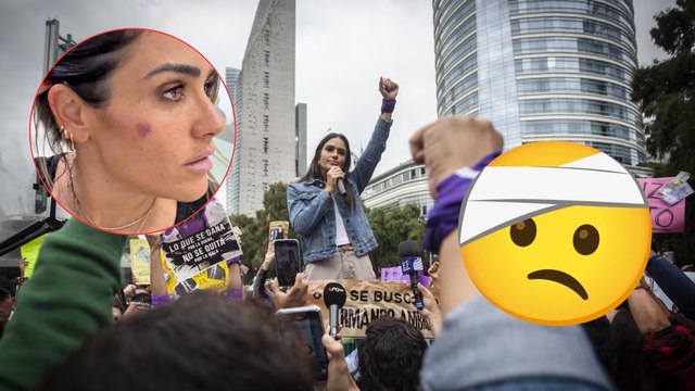 Alessandra Rojo de la Vega: alcaldesa de la Cuauhtémoc denuncia emboscada y muestra golpes en su rostro