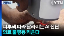 피부색 따라 달라지는 AI 진단...의료 불평등 키운다 / YTN