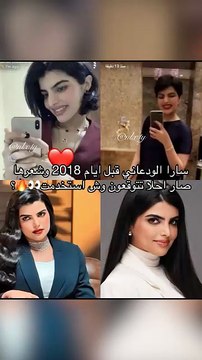 سارة الودعاني بتسوي تجميل جديد..شنو سوّت؟