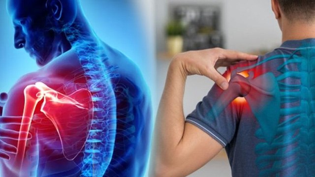 Frozen Shoulder vs Bursitis: Symptoms,Causes,Treatment In Hindi| फ्रोजन शोल्डर या बर्साइटिस