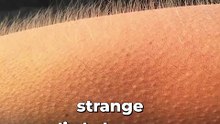 Human Goose Bumps are weird