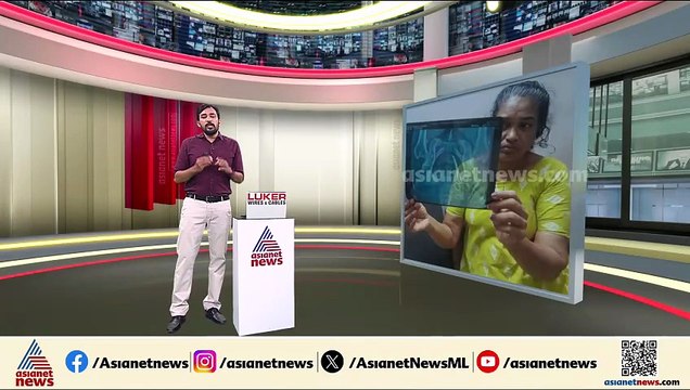 വണ്ടാനം മെഡിക്കൽ കോളേജിലെ ചികിത്സാപ്പിഴവ്; ഉഷയ്ക്ക് ആശ്വാസം; വയറിൽ നിന്നും ഫോർസെപ്സ് പുറത്തെടുത്തു