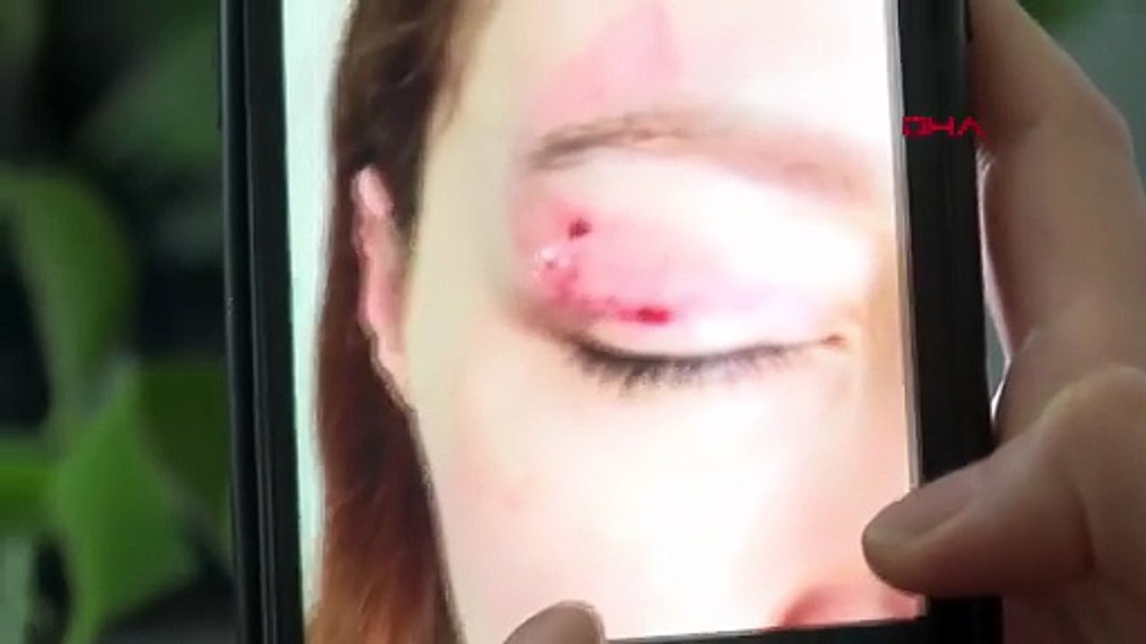 Güzellik merkezi mağduriyeti! Ucuza yaptırdı, düzeltilmesi için servet isteniyor