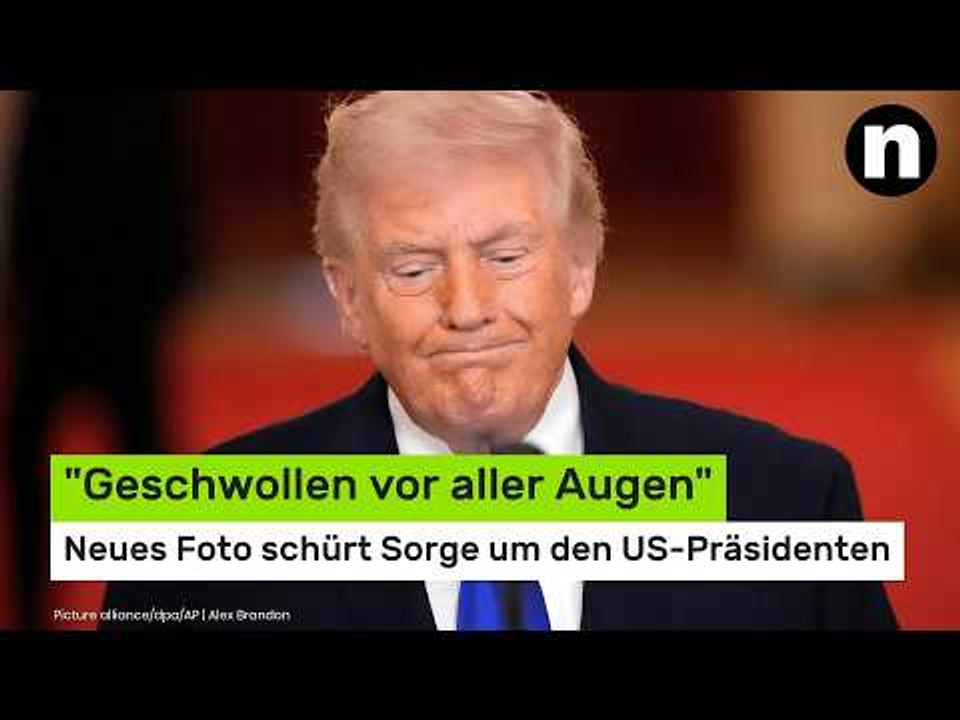 Donald Trump krank?: 'Geschwollen vor aller Augen' - neues Foto schürt Sorge um den US-Präsidenten