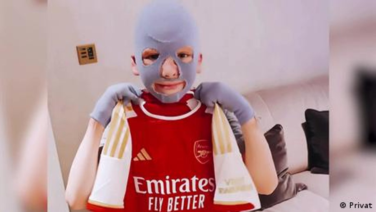 Wie ein verletzter Junge zum Gesicht Ukraine-Krieges wurde