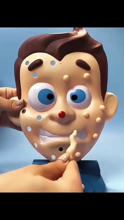 Popping Pimples Toy – Water Spraying Prank Game