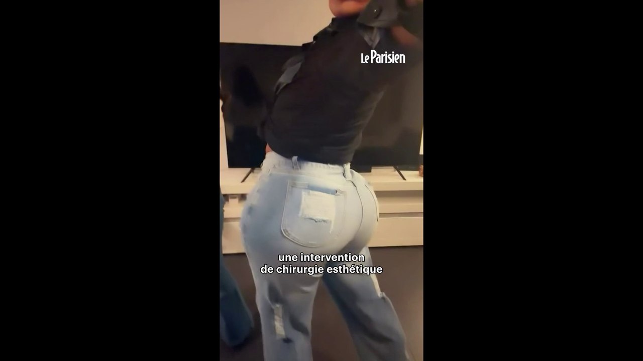 Mort de « Lip King », l’homme qui voulait ressembler à Kim Kardashian