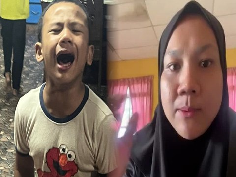 Anak usia setahun dah tumbuh bulu kemaluan, ibu dedah perubahan luar biasa