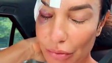 Ivete Sangalo recebe alta após ficar internada por desmaio