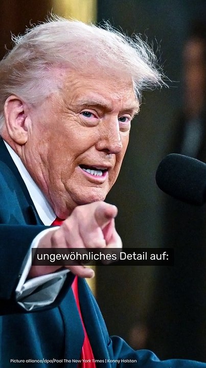 Donald Trump krank: Handverletzung stümperhaft kaschiert