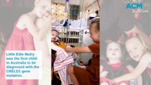 Two-year-old Edie Mulry is one of only two children in Australia with an extremely rare condition.