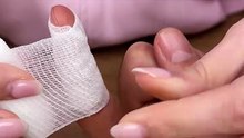 Easy bandage trick protection