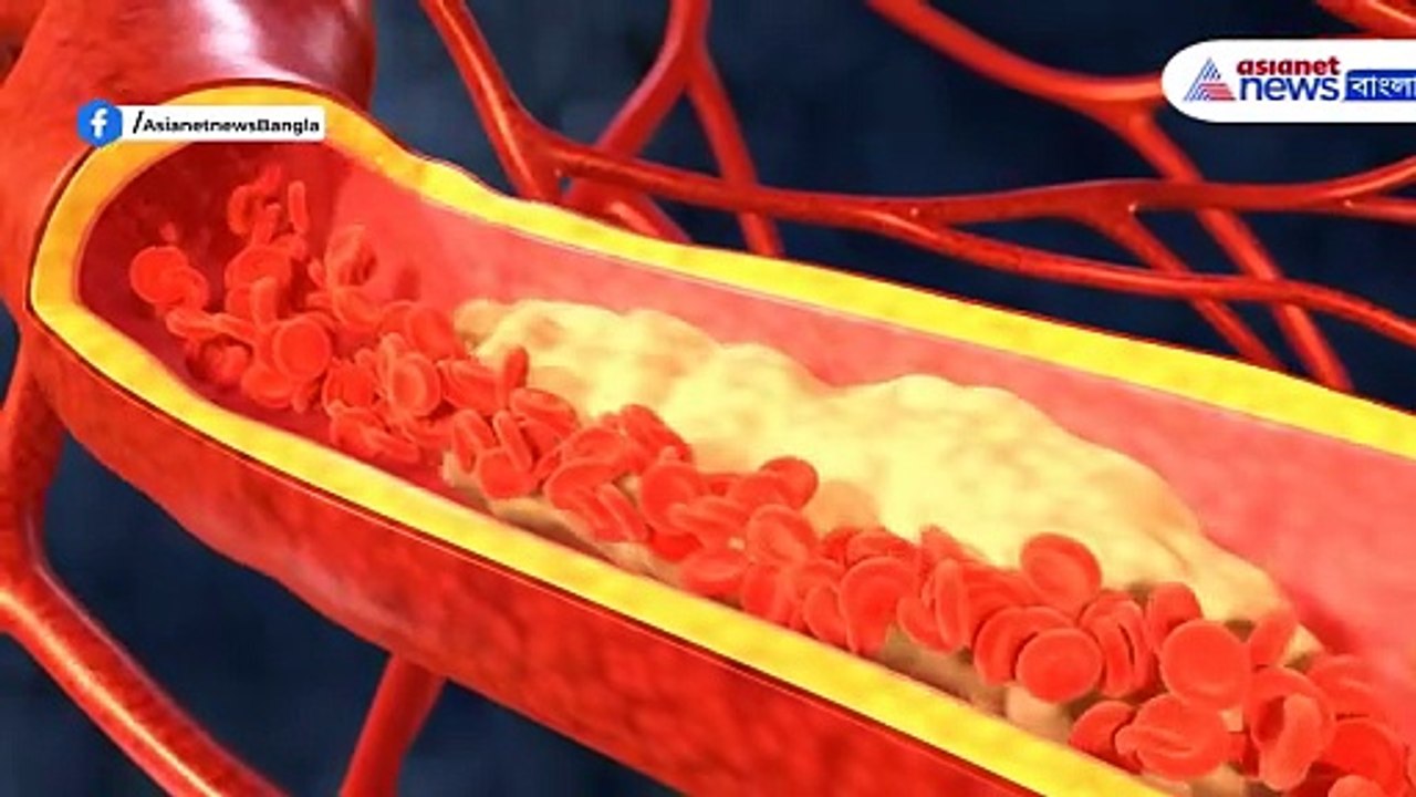 Cholesterol: কোলেস্টরল নিয়ে চিন্তিত? এই একটি অভ্যাস বদলে দেবে আপনার জীবন! দেখুন