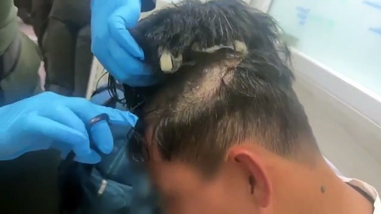 Así fue la detención de un hombre que llevaba cápsulas de cocaína en una peluca