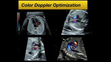 1. Optimizing Fetal Cardiac Imaging Gray Scale _ Color
