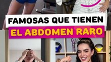 Famosas que tienen un abdomen raro