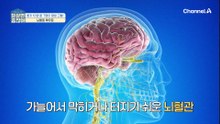 환자 10명 중 7명이 평생 고통! 뇌졸중 후유증이 심한 이유는?