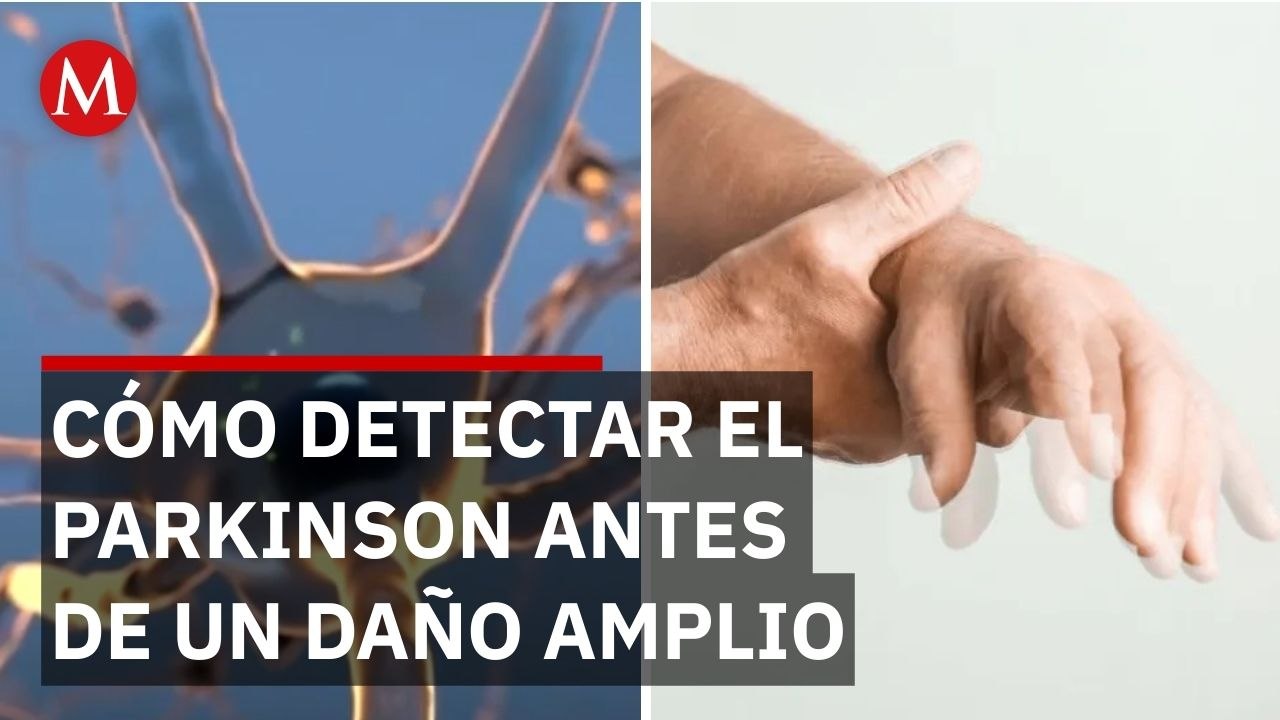 ¿Se puede frenar el Parkinson? IA detecta patrones genéticos antes de que el cerebro sufra daños