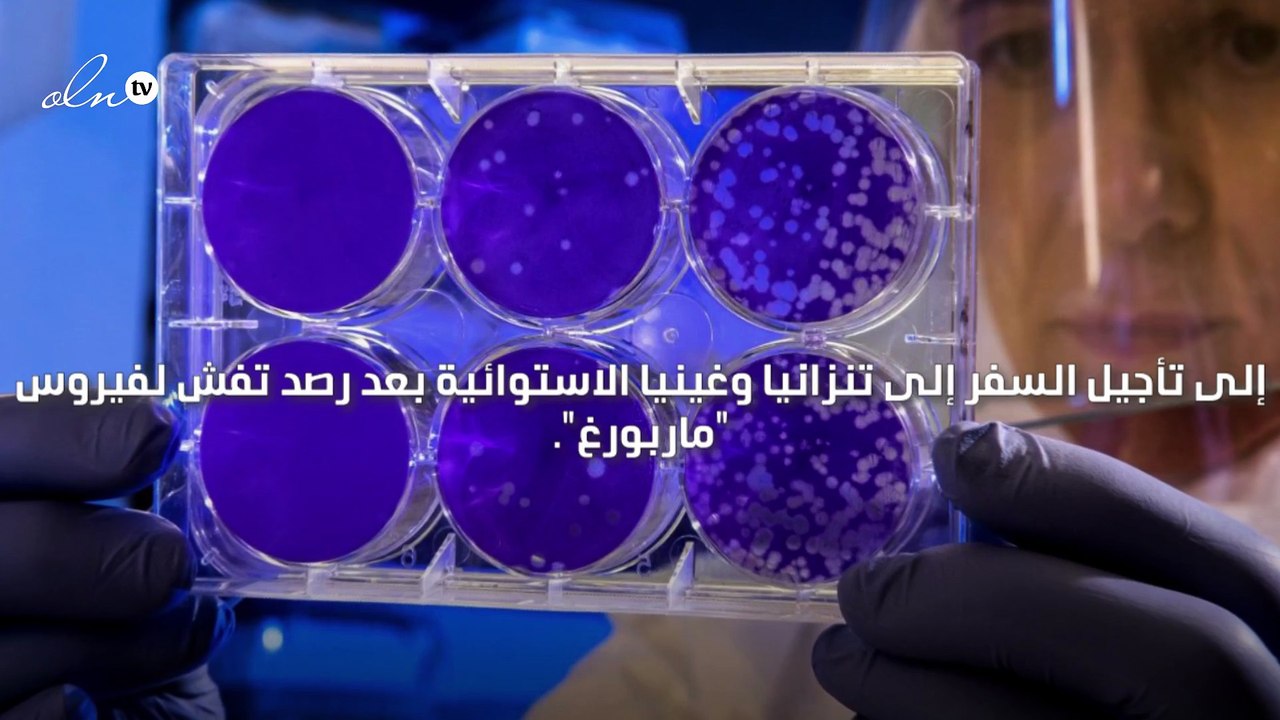 تفشي فيروس ماربورغ القاتل وتوصيات بعدم السفر إلى عدة دول افريقية